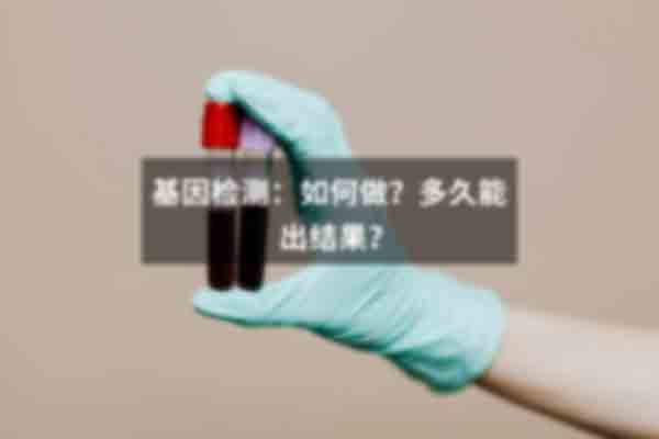 杭州市临平区做亲子鉴定价格是多少